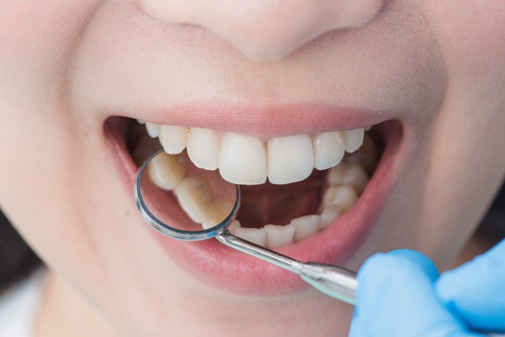 معایب و مضرات فلوراید برای دندان ها